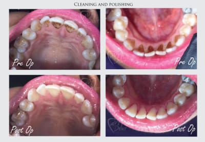 Почистване и полиране с Aqua Care