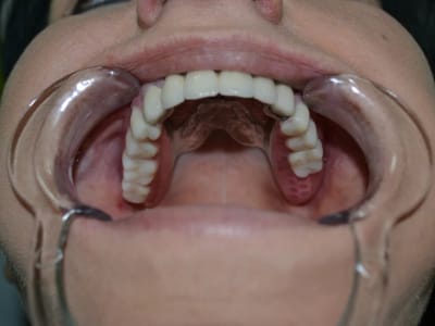 Естетична стоматология