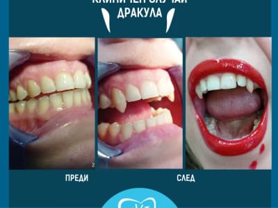 Специални случаи