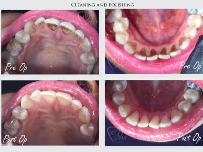 Хигиена и профилактика