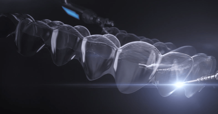 Какво представляват алайнерите Invisalign ?