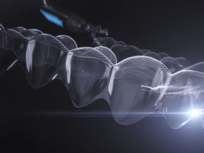 Какво представляват алайнерите Invisalign ?