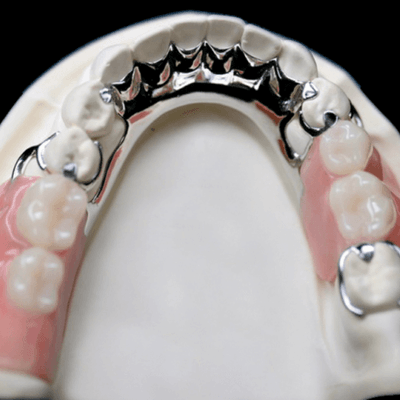 Снимка на частична протеза с метален скелет