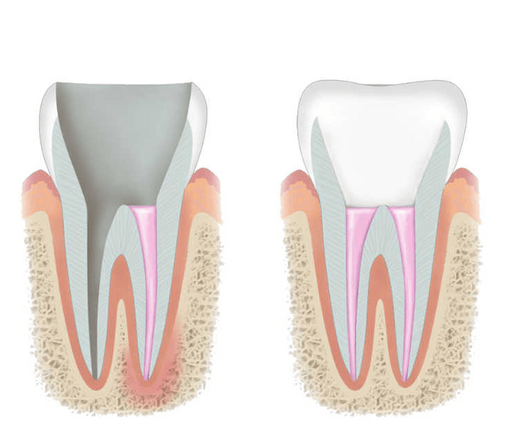 Кореново лечение