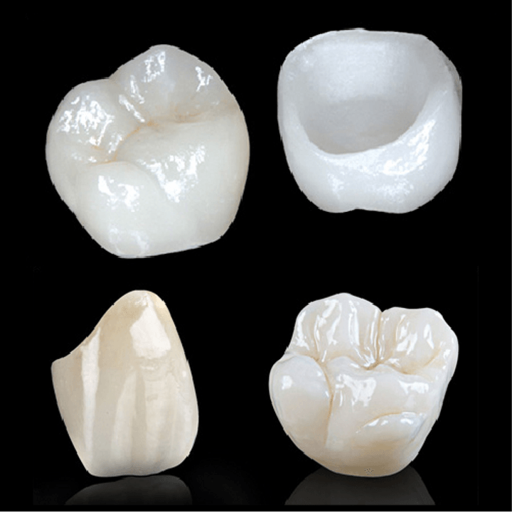 Литиево-дисиликатни коронки