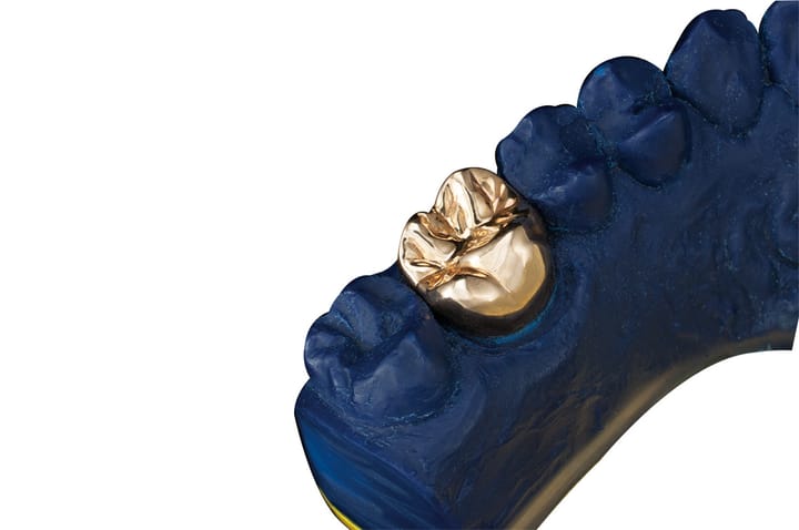 Метални коронки