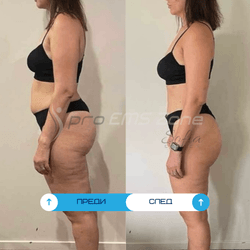 Преди и след клиенти