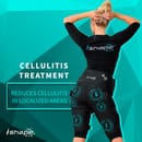 Процедура i-shape Esthetic