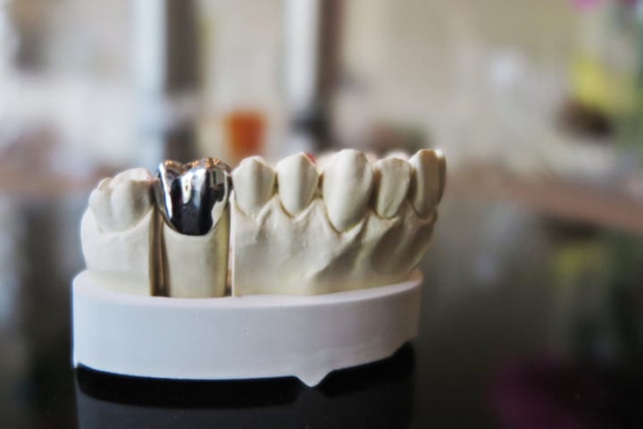 crowns