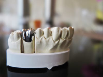 Prosthodontics