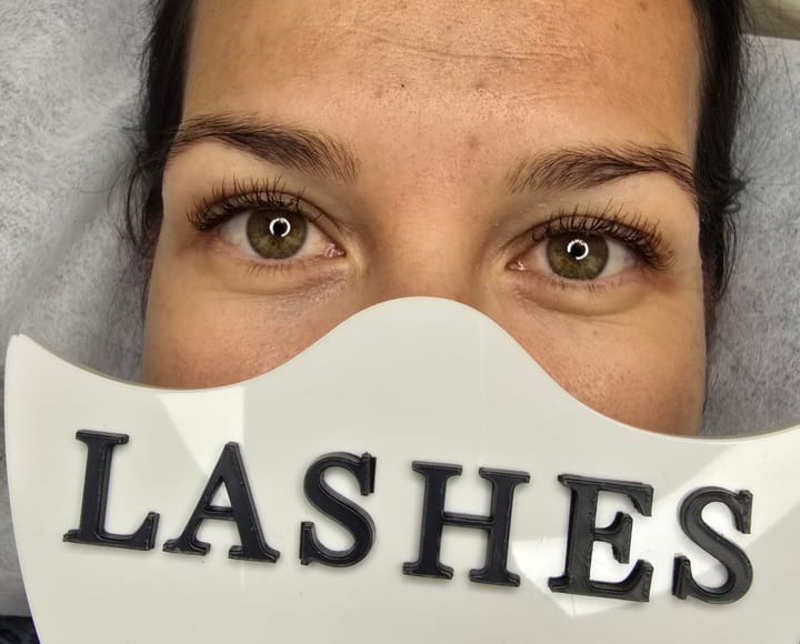 миглопластика