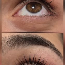 миглопластика- удължаване на мигли