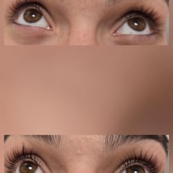 миглопластика- удължаване на мигли