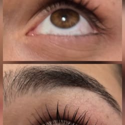 миглопластика- удължаване на мигли