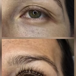 миглопластика- удължаване на мигли