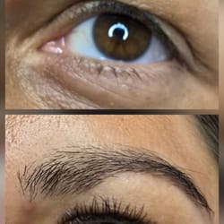 миглопластика- удължаване на мигли