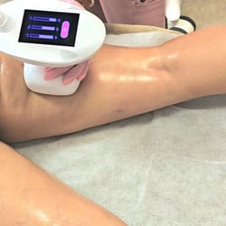 топене на мазнини с вакум и радиочестота София
