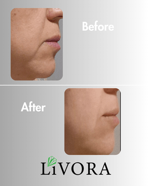 резултати на клиенти