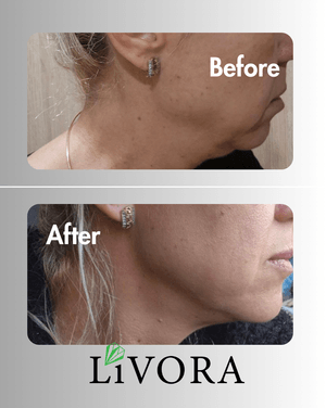 резултати на клиенти