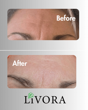 резултати на клиенти