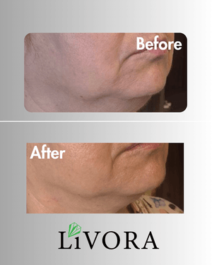 резултати от клиенти