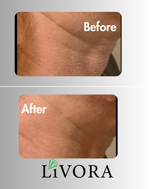 резултати от клиенти