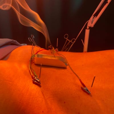 Мокситерапия