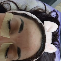 процедура за лиеце