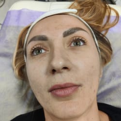 процедура за лице